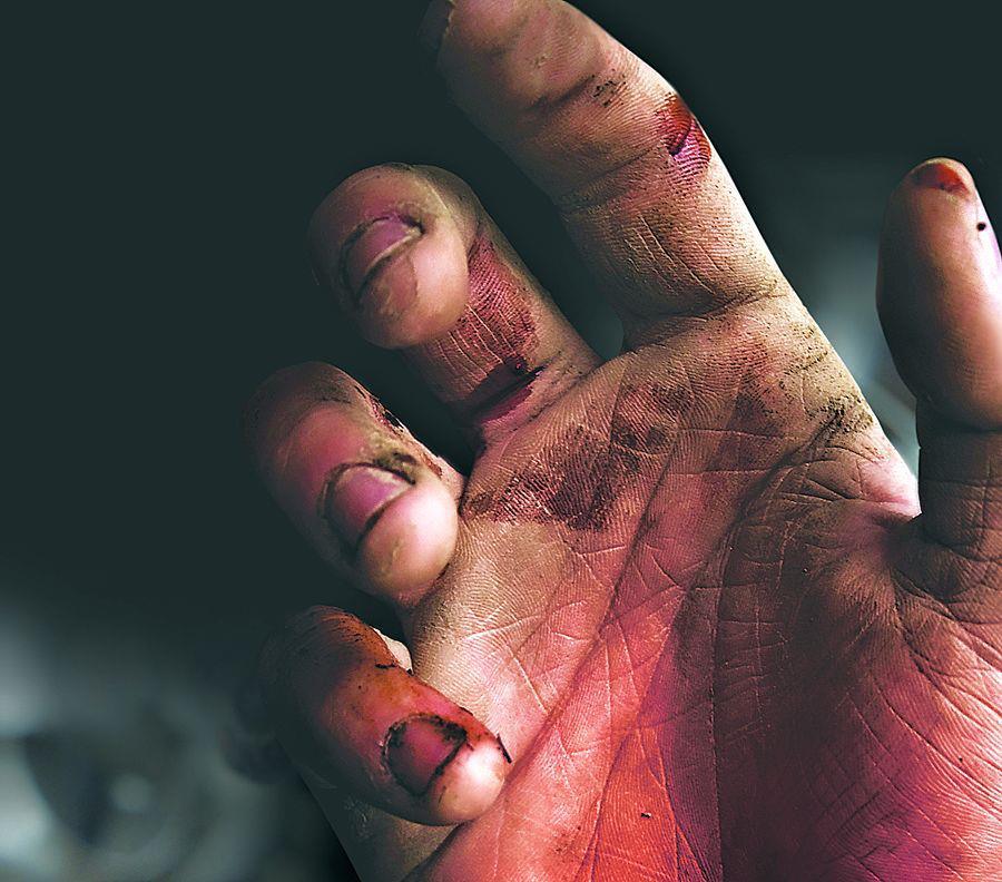 نقش دستکش‌های ایمنی و آسیب محل کار